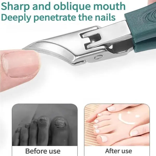 Sikunuo | 3-piece nail care set for ingrown nails